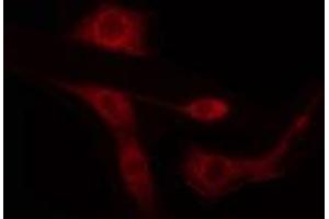 ABIN6274434 staining LOVO cells by IF/ICC. (ARID1B antibody  (Internal Region))