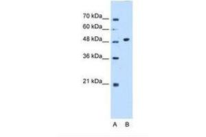 Image no. 1 for anti-Glycosyltransferase-Like Domain Containing 1 (GTDC1) (AA 101-150) antibody (ABIN6738521) (GTDC1 antibody  (AA 101-150))