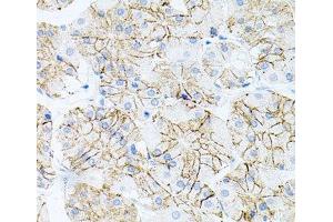 Immunohistochemistry of paraffin-embedded Human stomach using IL17A Polyclonal Antibody at dilution of 1:100 (40x lens). (Interleukin 17a antibody)