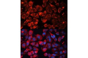 Immunofluorescence analysis of HeLa cells using CASP3 antibody. (Caspase 3 antibody  (AA 55-160))
