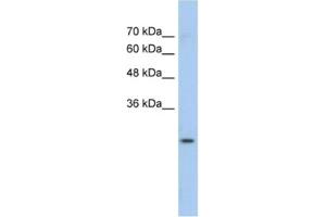 Western Blotting (WB) image for anti-Glutathione S-Transferase mu 1 (GSTM1) antibody (ABIN2462473) (GSTM1 antibody)