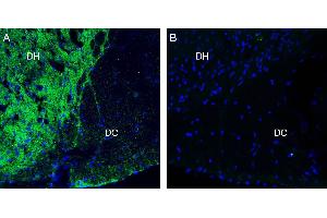 Expression of Neurofascin in rat spinal cord. (NFASC antibody  (C-Term, Intracellular))