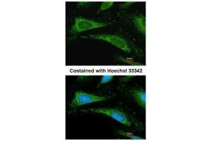 ICC/IF Image Immunofluorescence analysis of methanol-fixed HeLa, using Cyclophilin A, antibody at 1:200 dilution. (PPIA antibody  (C-Term))