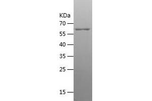 Western Blotting (WB) image for Creatine Kinase, Brain (CKB) (AA 1-381) protein (His-IF2DI Tag) (ABIN7283702) (CKB Protein (AA 1-381) (His-IF2DI Tag))