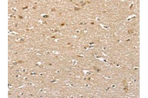 The image on the left is immunohistochemistry of paraffin-embedded Human brain tissue using ABIN7130610(PHLPP1 Antibody) at dilution 1/35, on the right is treated with fusion protein.