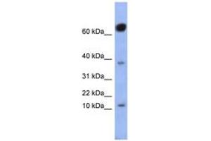 Image no. 1 for anti-NK6 Homeobox 3 (NKX6-3) (AA 71-120) antibody (ABIN6742923) (NK6 Homeobox 3 antibody  (AA 71-120))
