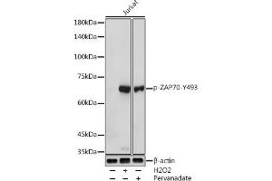 Western blot analysis of extracts of Jurkat cells, using Phospho-Z-Y493 antibody (ABIN3020534, ABIN3020535, ABIN3020536, ABIN1682145 and ABIN1682146) at 1:1000 dilution. (ZAP70 antibody  (pTyr493))
