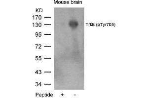 Image no. 1 for anti-Neurotrophic Tyrosine Kinase, Receptor, Type 2 (NTRK2) (pTyr705) antibody (ABIN319265) (TRKB antibody  (pTyr705))