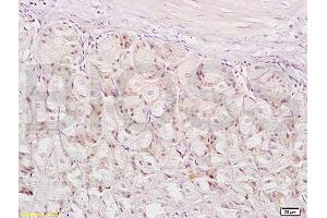 Formalin-fixed and paraffin embedded mouse stomach labeled with Anti-XAF1/FBXO39 Polyclonal Antibody, Unconjugated (ABIN674754) at 1:200 followed by conjugation to the secondary antibody and DAB staining. (XAF1 antibody  (AA 151-250))