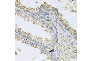 Immunohistochemistry of paraffin-embedded human prostate using PPIC antibody. (PPIC antibody  (AA 23-212))