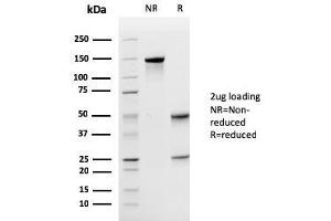 SDS-PAGE Analysis Purified Uroplakin 1A Mouse Monoclonal Antibody (UPK1A/2925). (UPK1A antibody  (AA 114-173))
