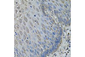 Immunohistochemistry of paraffin-embedded human esophagus using IL1A antibody (ABIN6291332) at dilution of 1:100 (40x lens).