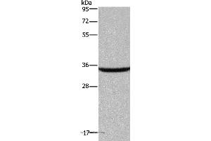 Western blot analysis of Human fetal brain tissue, using DKK3 Polyclonal Antibody at dilution of 1:200 (DKK3 antibody)