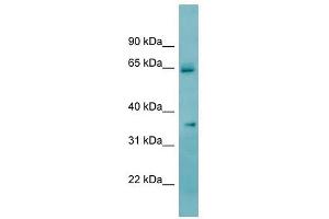 KHK antibody used at 1 ug/ml to detect target protein.