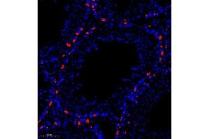 Immunofluorescence of paraffin embedded mouse testis using PP4R2 (ABIN7075284) at dilution of 1:1000 (280x lens) (PPP4R2 antibody)