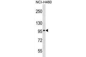 Western Blotting (WB) image for anti-Solute Carrier Family 8 (Sodium/calcium Exchanger), Member 3 (SLC8A3) antibody (ABIN2996958) (SLC8A3 antibody)