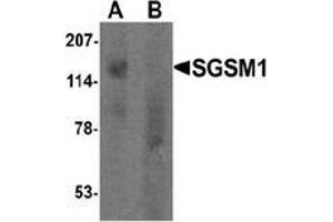 Western blot analysis of SGSM1 in human cerebellum tissue lysate with SGSM1 Antibody  at 1 μg/ml in (A) the absence and (B) the presence of blocking peptide. (SGSM1 antibody  (Middle Region))