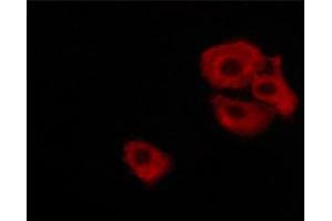 ABIN6267697 staining MKN-45 cells treated with Forskolin 30 μM, 20 min by ICC/IF. (DARPP32 antibody  (pThr34))