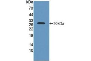 Detection of Recombinant ABCC2, Human using Polyclonal Antibody to ATP Binding Cassette Transporter C2 (ABCC2) (ABCC2 antibody  (AA 1300-1534))