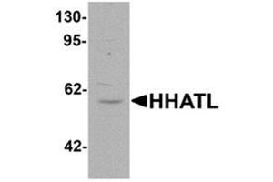 Western blot analysis of HHATL in 3T3 cell lysate with HHATL antibody at 1 ug/mL. (HHATL antibody  (N-Term))