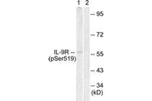 Western blot analysis of extracts from HuvEc cells, using IL-9R (Phospho-Ser519) Antibody. (IL9 Receptor antibody  (pSer519))