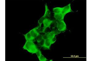 Immunofluorescence of purified MaxPab antibody to DTNA on 293 cell. (DTNA antibody  (AA 1-371))