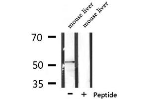 Western blot analysis of extracts from mouse liver, using RASGEF1C Antibody. (RASGEF1C antibody  (Internal Region))