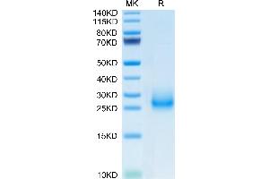 Mouse CD7 on Tris-Bis PAGE under reduced condition. (CD7 Protein (CD7) (AA 24-150) (His tag))
