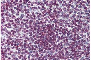 Human Spleen: Formalin-Fixed, Paraffin-Embedded (FFPE) (FOXO3 antibody  (AA 361-460))