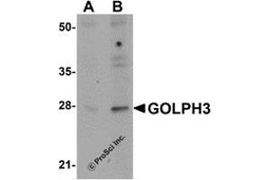 Western Blotting (WB) image for anti-Golgi phosphoprotein 3 (Coat-Protein) (GOLPH3) (N-Term) antibody (ABIN1031394) (GOLPH3 antibody  (N-Term))