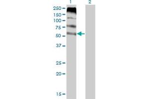 Western Blot analysis of FLVCR expression in transfected 293T cell line by FLVCR monoclonal antibody (M05), clone 4B2. (FLVCR antibody  (AA 1-83))