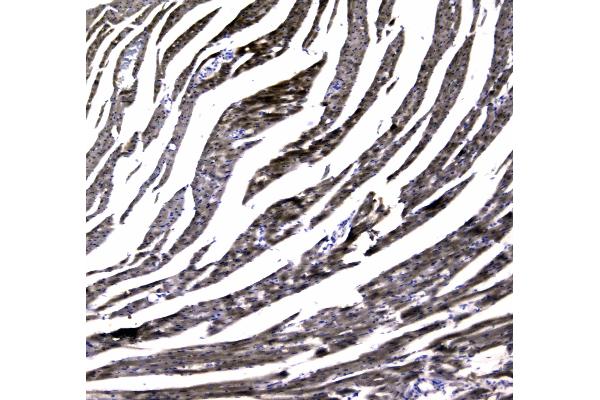 MYBPC3 antibody  (AA 1070-1123)