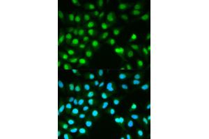 Immunofluorescence analysis of HeLa cell using PPP3CA antibody. (PPP3CA antibody)