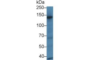 Detection of RBP3 in Mouse Eye lysate using Polyclonal Antibody to Retinol Binding Protein 3, Interstitial (RBP3) (RBP3 antibody  (AA 1027-1229))