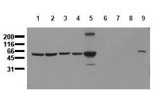 Western Blotting (WB) image for anti-Vimentin (VIM) antibody (ABIN126914) (Vimentin antibody)