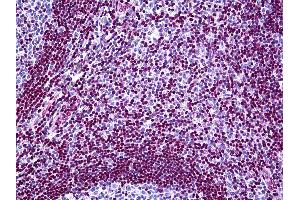 Anti-MECP2 antibody IHC of human tonsil. (MECP2 antibody  (AA 81-170))