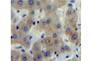 Used in DAB staining on fromalin fixed paraffin-embedded Liver tissue (FCN1 antibody  (AA 25-317))