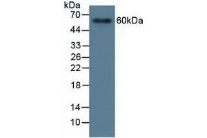 Detection of MMP19 in Human Serum using Polyclonal Antibody to Matrix Metalloproteinase 19 (MMP19)