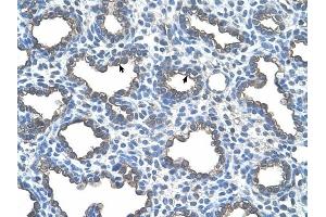 UBE2D2 antibody was used for immunohistochemistry at a concentration of 4-8 ug/ml to stain Alveolar cells (arrows) in Human Lung. (UBE2D2 antibody)
