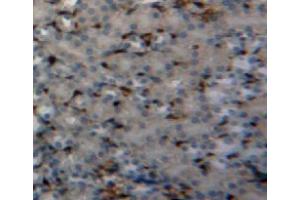 Used in DAB staining on fromalin fixed paraffin-embedded kidney tissue (PIN1 antibody  (AA 2-165))
