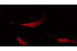 ABIN6267670 staining NIH-3T3 cells by IF/ICC.