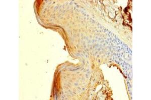 Immunohistochemistry of paraffin-embedded human skin tissue using ABIN7148585 at dilution of 1:100 (SPRR1B antibody  (AA 1-89))