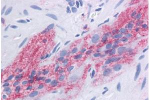 Human Colon, myenteric plexus: Formalin-Fixed, Paraffin-Embedded (FFPE) (CD9 antibody)