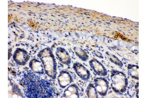 Immunohistochemistry (IHC) image for anti-Isocitrate Dehydrogenase 2 (NADP+), Mitochondrial (IDH2) (AA 413-447), (C-Term) antibody (ABIN3043856)