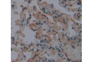 IHC-P analysis of Human Tissue, with DAB staining. (FGL2 antibody  (AA 24-439))
