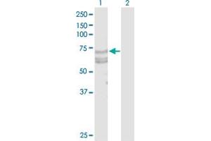 Western Blot analysis of TNFRSF21 expression in transfected 293T cell line by TNFRSF21 MaxPab polyclonal antibody. (TNFRSF21 antibody  (AA 1-655))