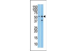 The anti-R Pab (ABIN388684 and ABIN2838672) is used in Western blot to detect R in T47D (left) and Jurkat (right) cell line lysates. (URI1 antibody  (C-Term))