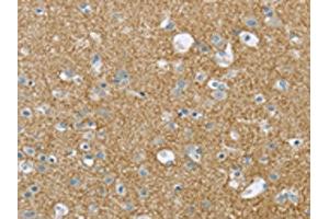 The image on the left is immunohistochemistry of paraffin-embedded Human brain tissue using ABIN7193008(VAMP2 Antibody) at dilution 1/20, on the right is treated with synthetic peptide. (VAMP2 antibody)