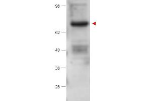 Image no. 1 for anti-Protein Kinase C, beta (PRKCB) (Internal Region) antibody (ABIN401432)