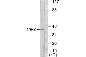 Western blot analysis of extracts from LOVO cells, using Fra-2 antibody (#C0197). (FOSL2 antibody)